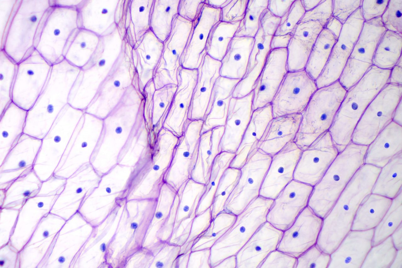 onion-epidermis-with-large-cells-under-microscope-2021-08-26-16-57-30-utc-scaled-1280x854.jpg